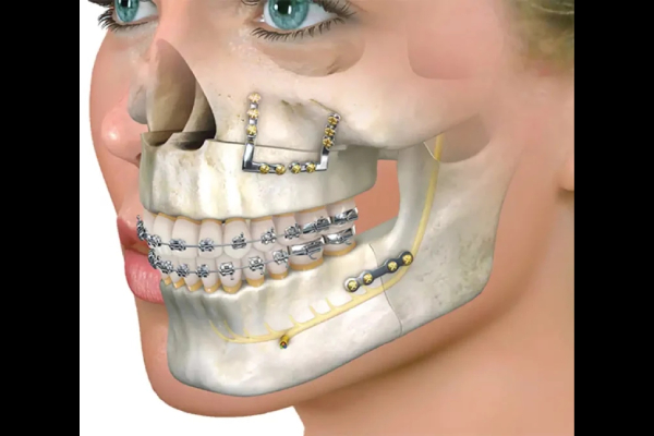 Oral and Maxillofacial Surgery
                